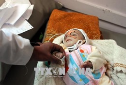 Tổng thống Iran quan ngại về khủng hoảng nhân đạo tại Yemen 